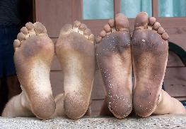 vieze voeten in Galibi